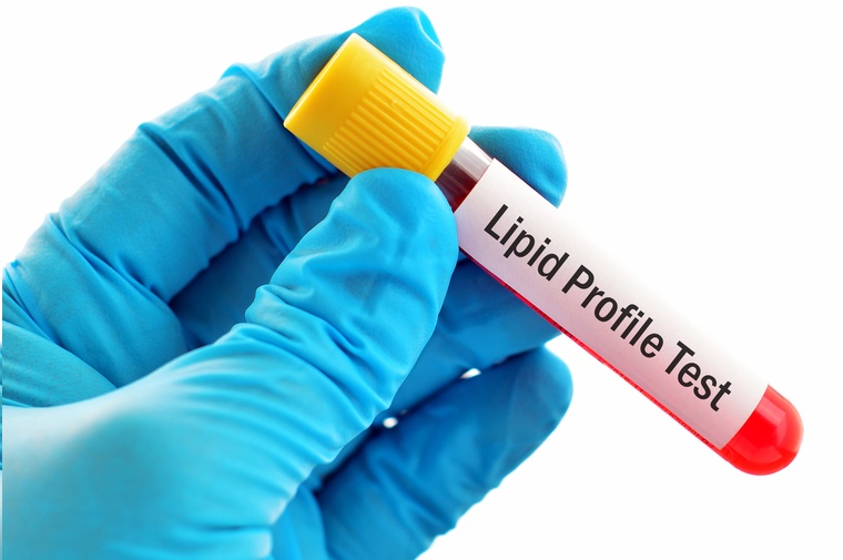 Lipid profile