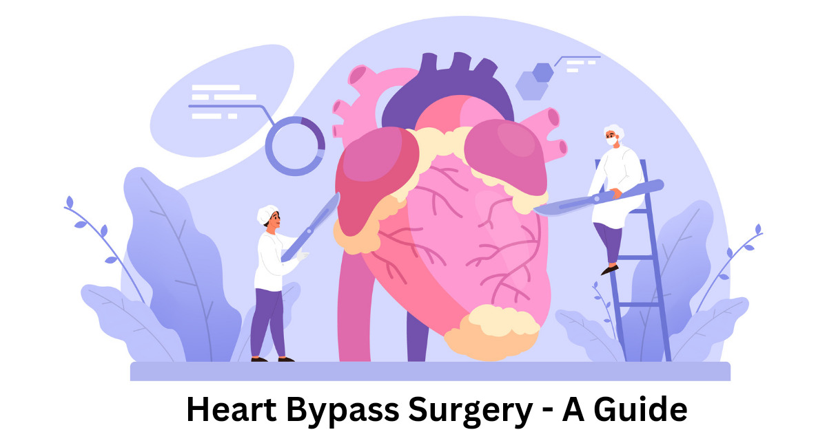 Heart Bypass Surgery