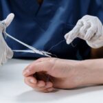 The Importance of Hiring a Specialized Personal Injury Attorney