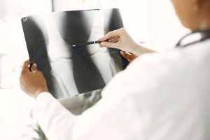 When Is It Safe to Resume Physical Activity After Knee Reconstruction? When Is It Safe to Resume Physical Activity After Knee Reconstruction