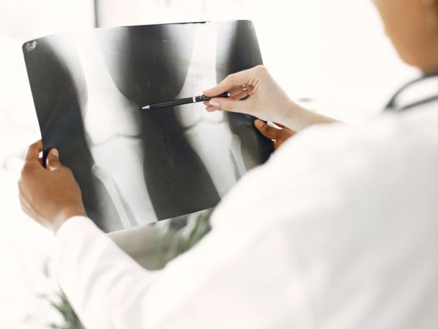 When Is It Safe to Resume Physical Activity After Knee Reconstruction? When Is It Safe to Resume Physical Activity After Knee Reconstruction